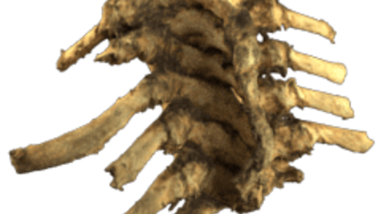 Part of backbone and ribs