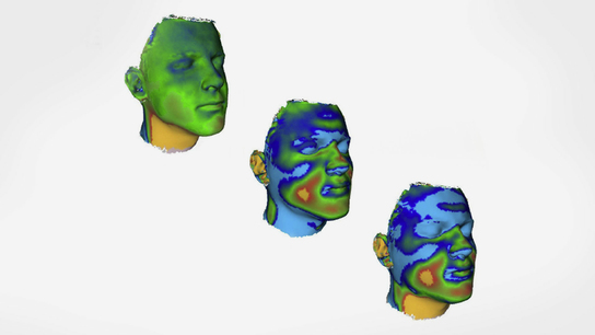 Using Artec Eva to measure shifts in facial soft tissues
