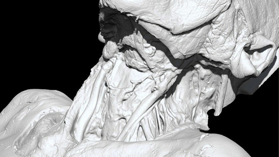 Artec 3D scanners and Geomagic Freeform software used in healthcare