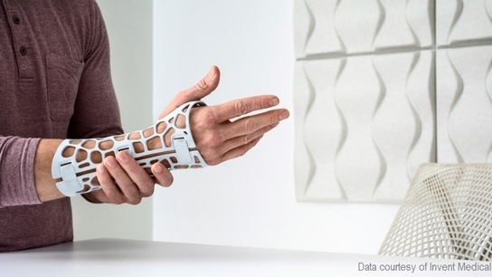 Learn how to bring 3D scanning into your Orthotics and Prosthetics workflow with HP & Artec 3D