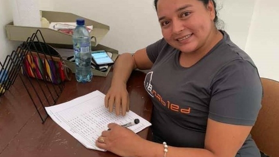 Artec Eva helps create low-cost, 3D-printed prostheses in Guatemala