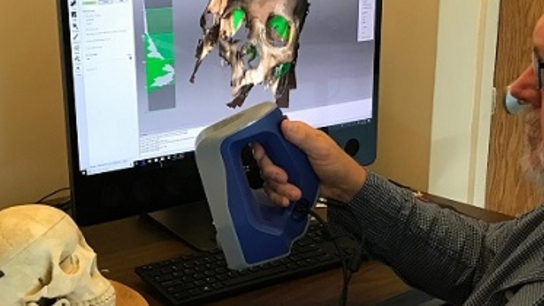 Illuminating the field of forensic anthropology with Artec 3D scanners